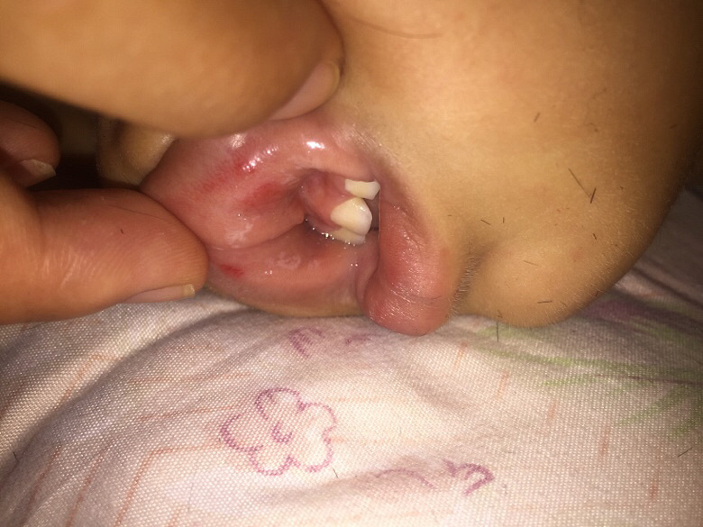 �����ı�������������ģ�