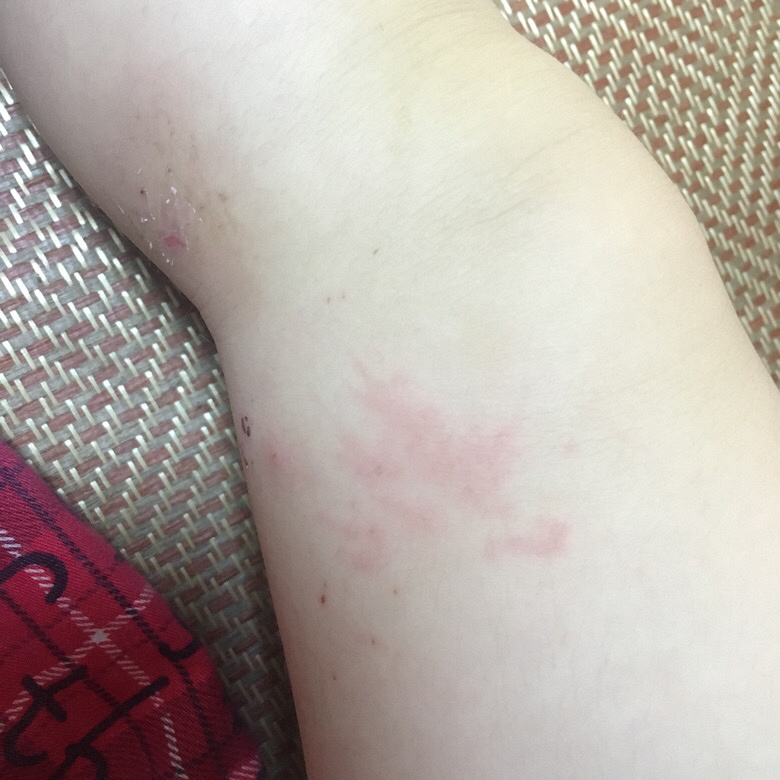 ���ʲôƤ������