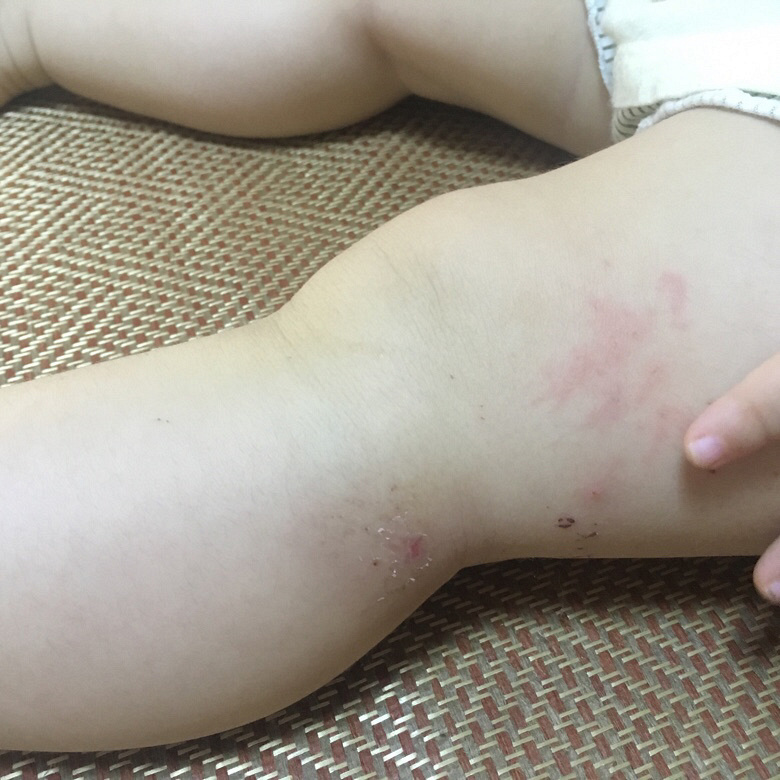 ���ʲôƤ������