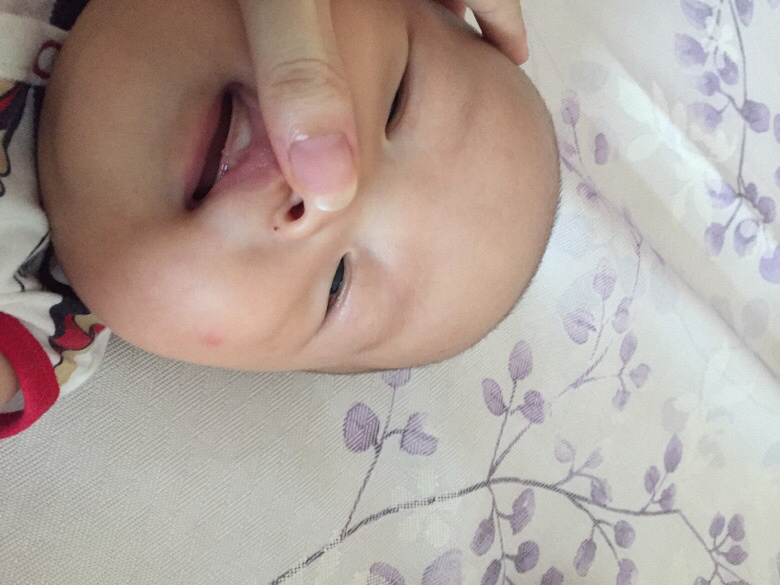 ��ҽ�������������ϰװ׵���ʲô����������