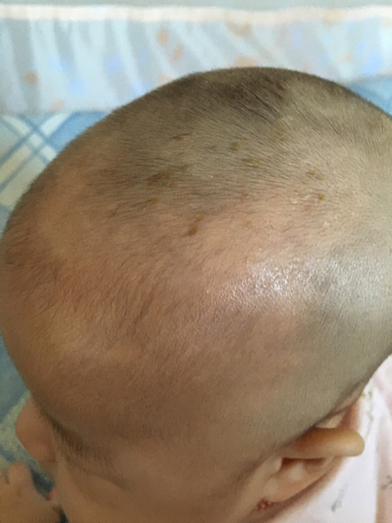 ����´�Ӥ��ͷ���а�ɫ�߿�