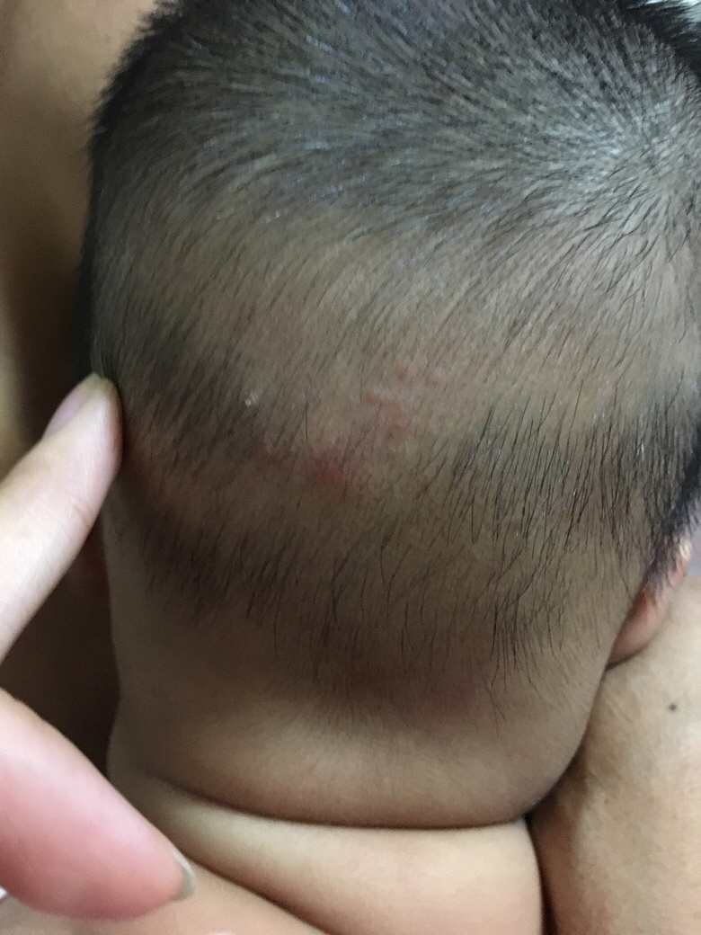 ����ͷ�������ʲô�����췢�ֵ�