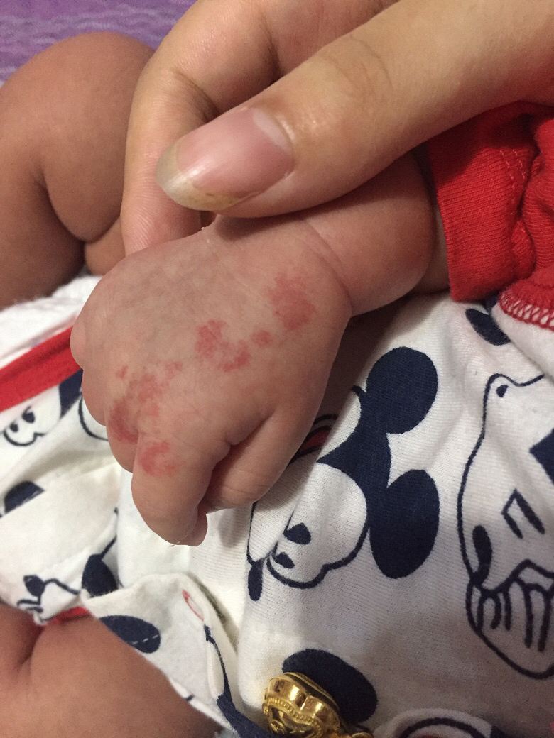 ��ҽ���������Ǽұ�����������ʲô����