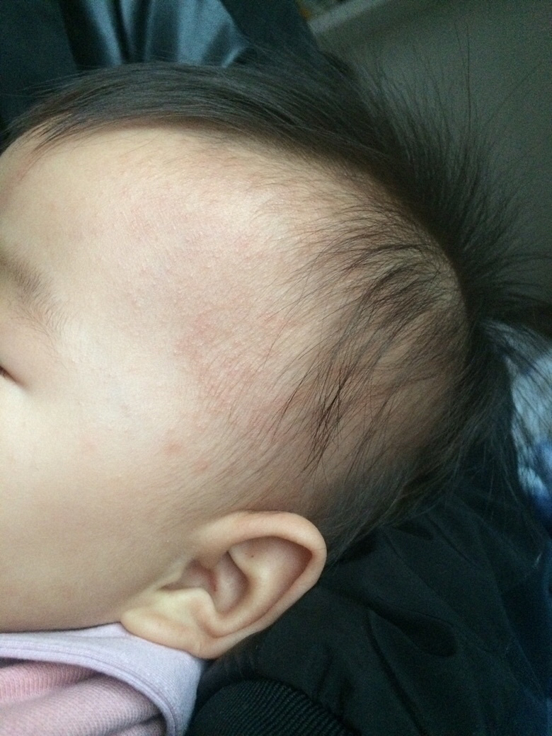 ������ҽ������ʪ��������ʲô������