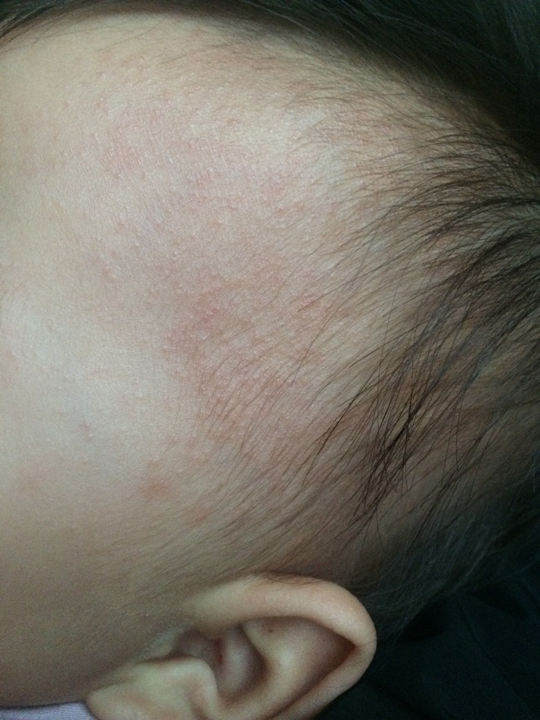 ������ҽ������ʪ��������ʲô������