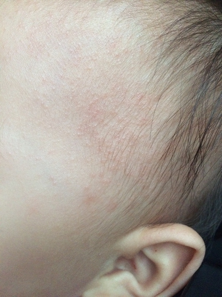 ������ҽ������ʪ��������ʲô������