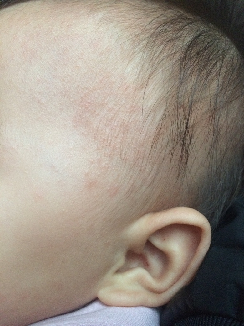 ������ҽ������ʪ��������ʲô������