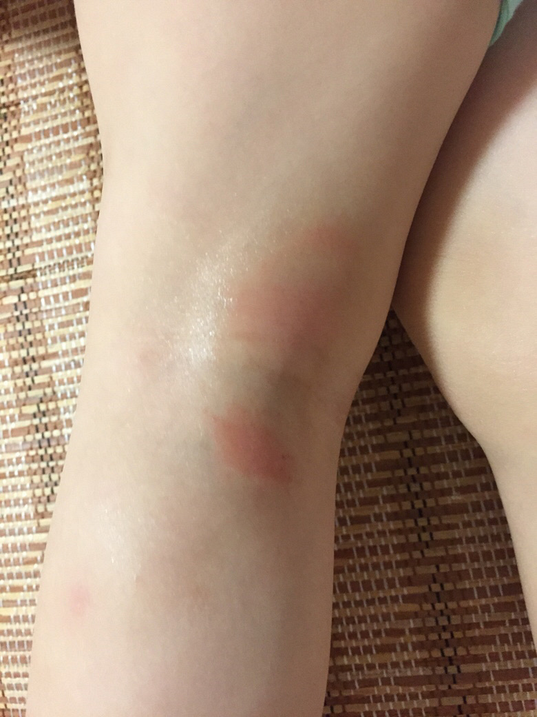 ��û��Ƥ����ҽ����æ����