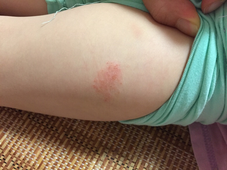 ��û��Ƥ����ҽ����æ����