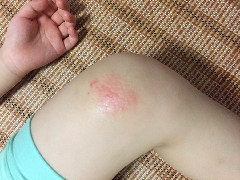 ��û��Ƥ����ҽ����æ����