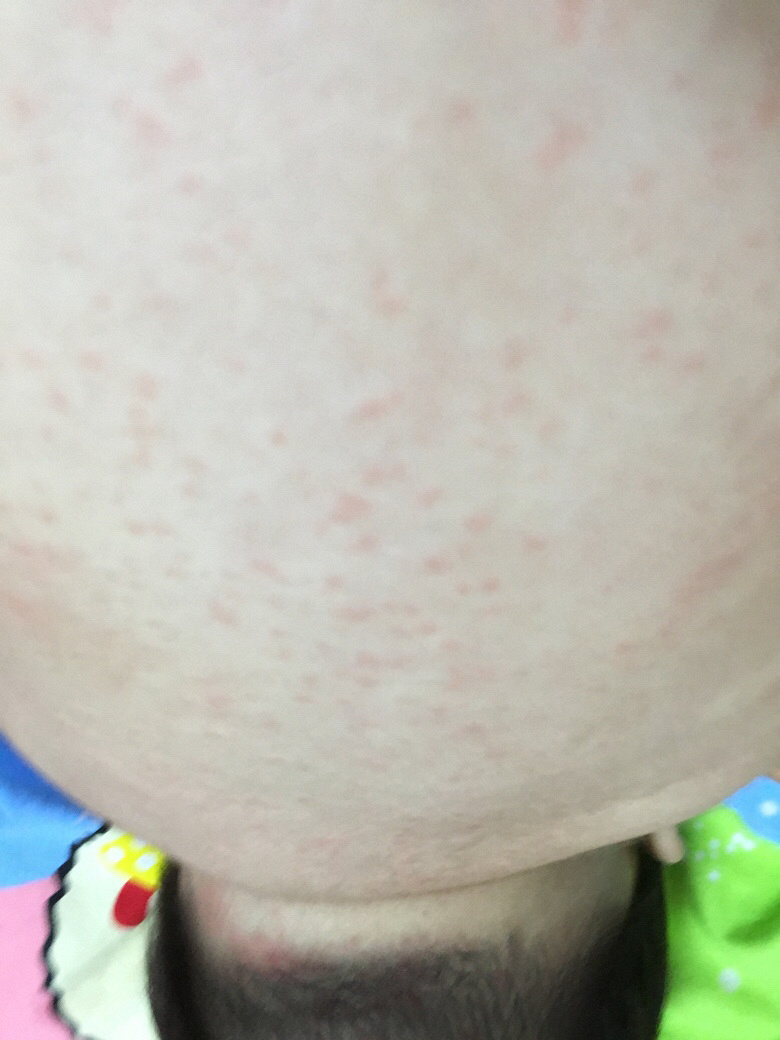 ��ҽ������æ����