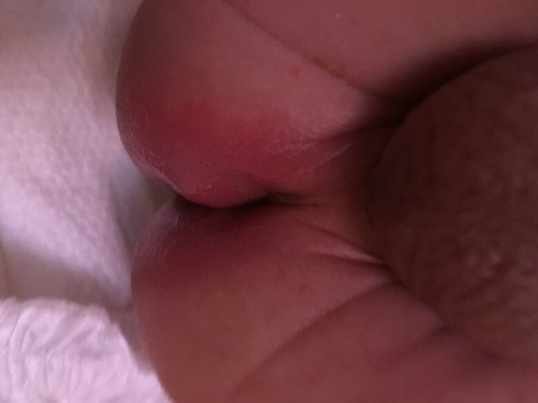 ������ƨ������