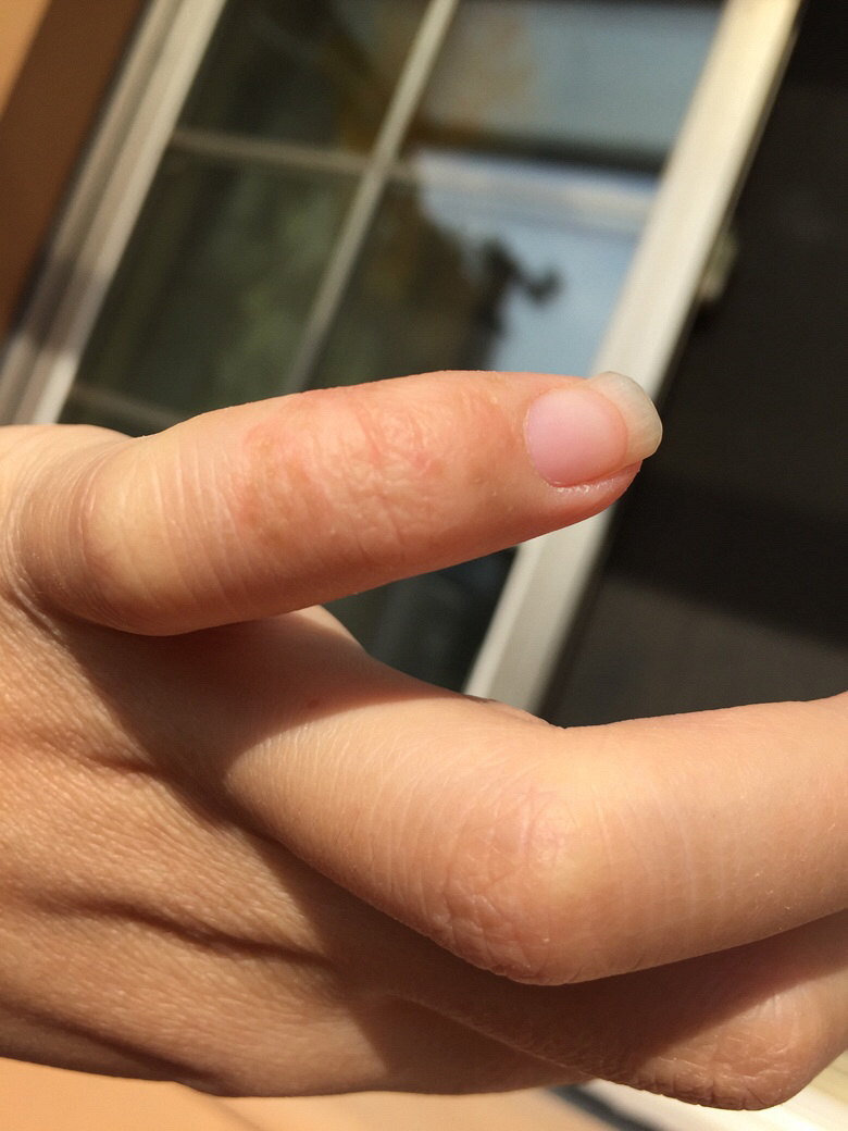 Ƥ���������Ǹ���ȱˮ��