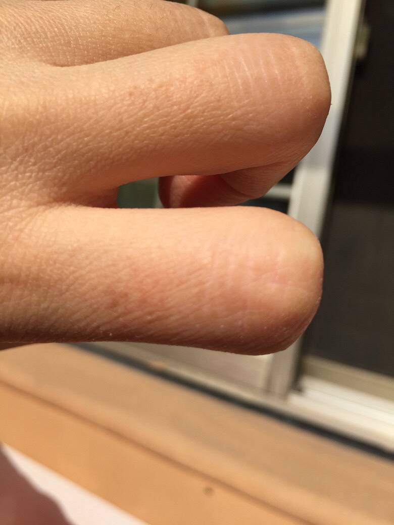 Ƥ���������Ǹ���ȱˮ��