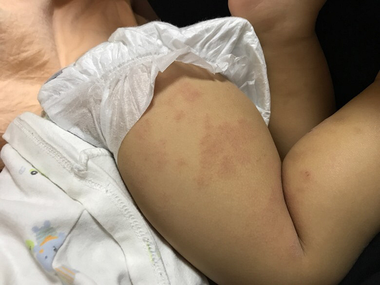 һ��࣬���˶���Ƥ���ͺܸɣ�����һ����