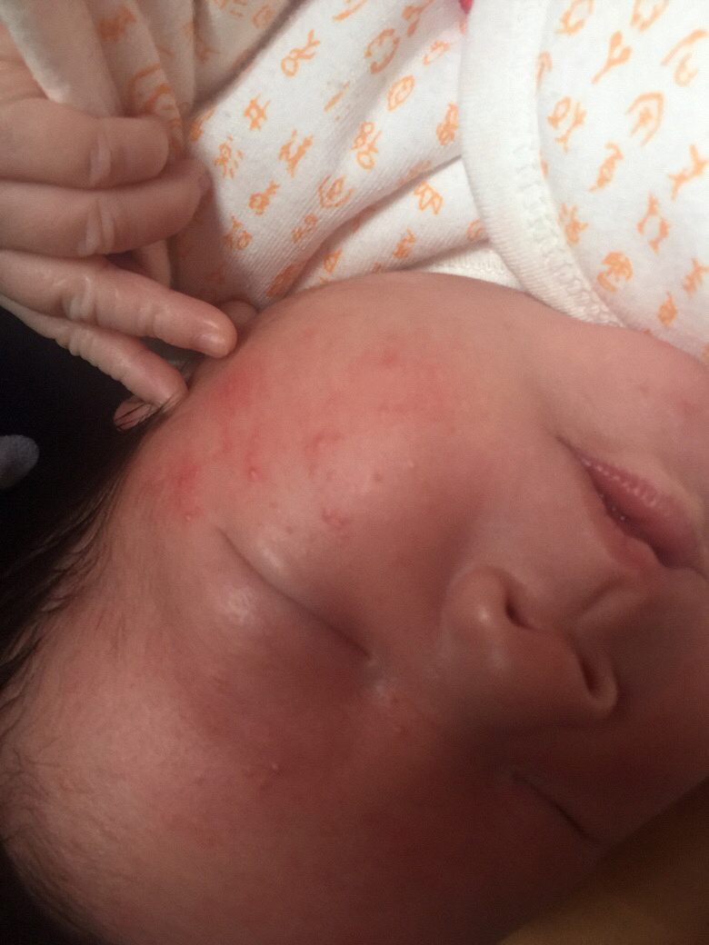 ����ʪ���� ��Ҫ��ô����