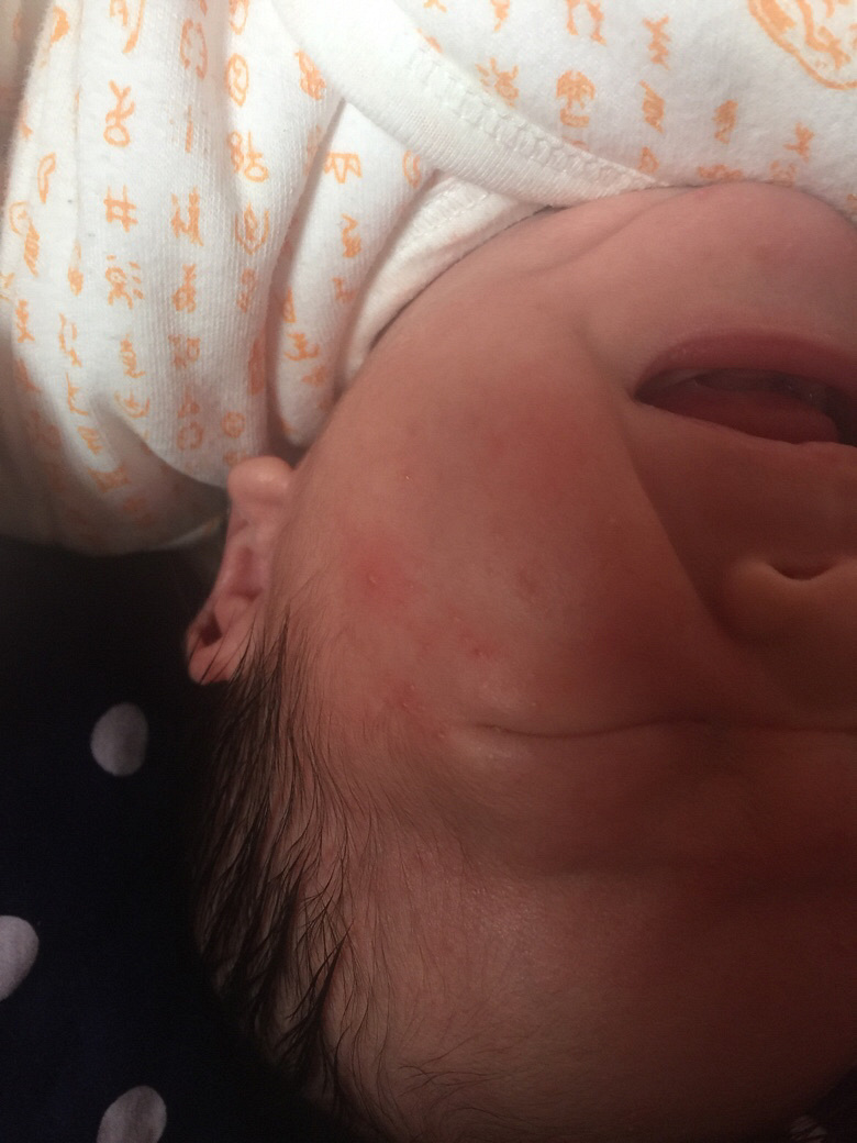 ����ʪ���� ��Ҫ��ô����