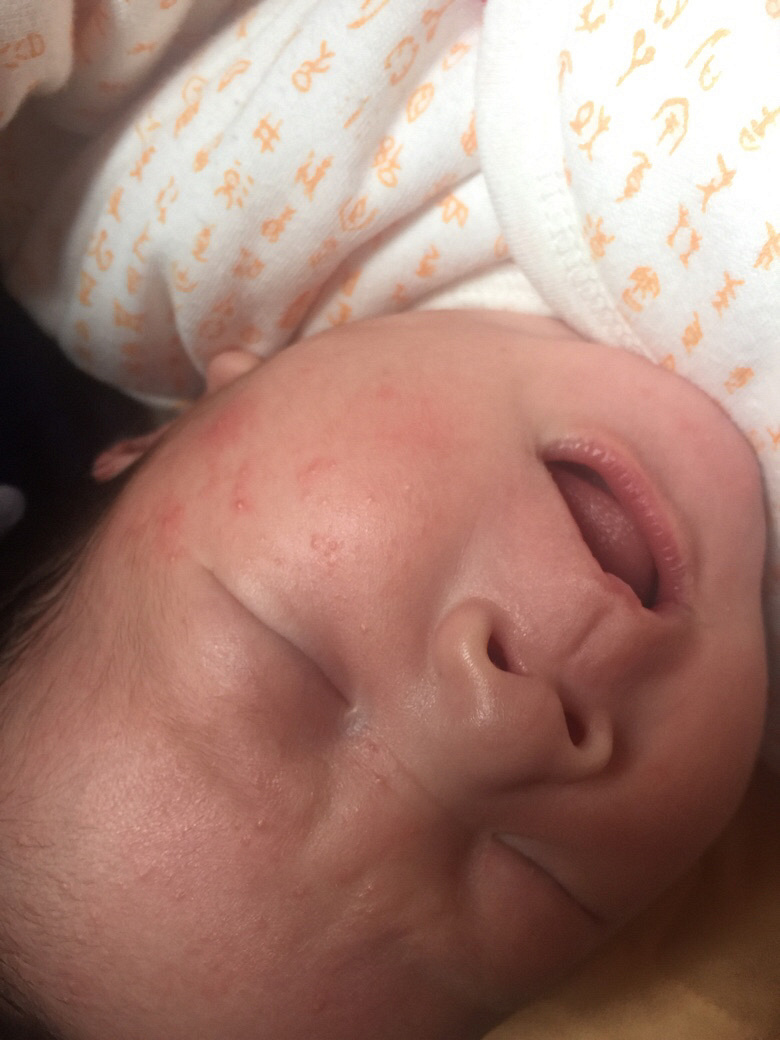 ����ʪ���� ��Ҫ��ô����