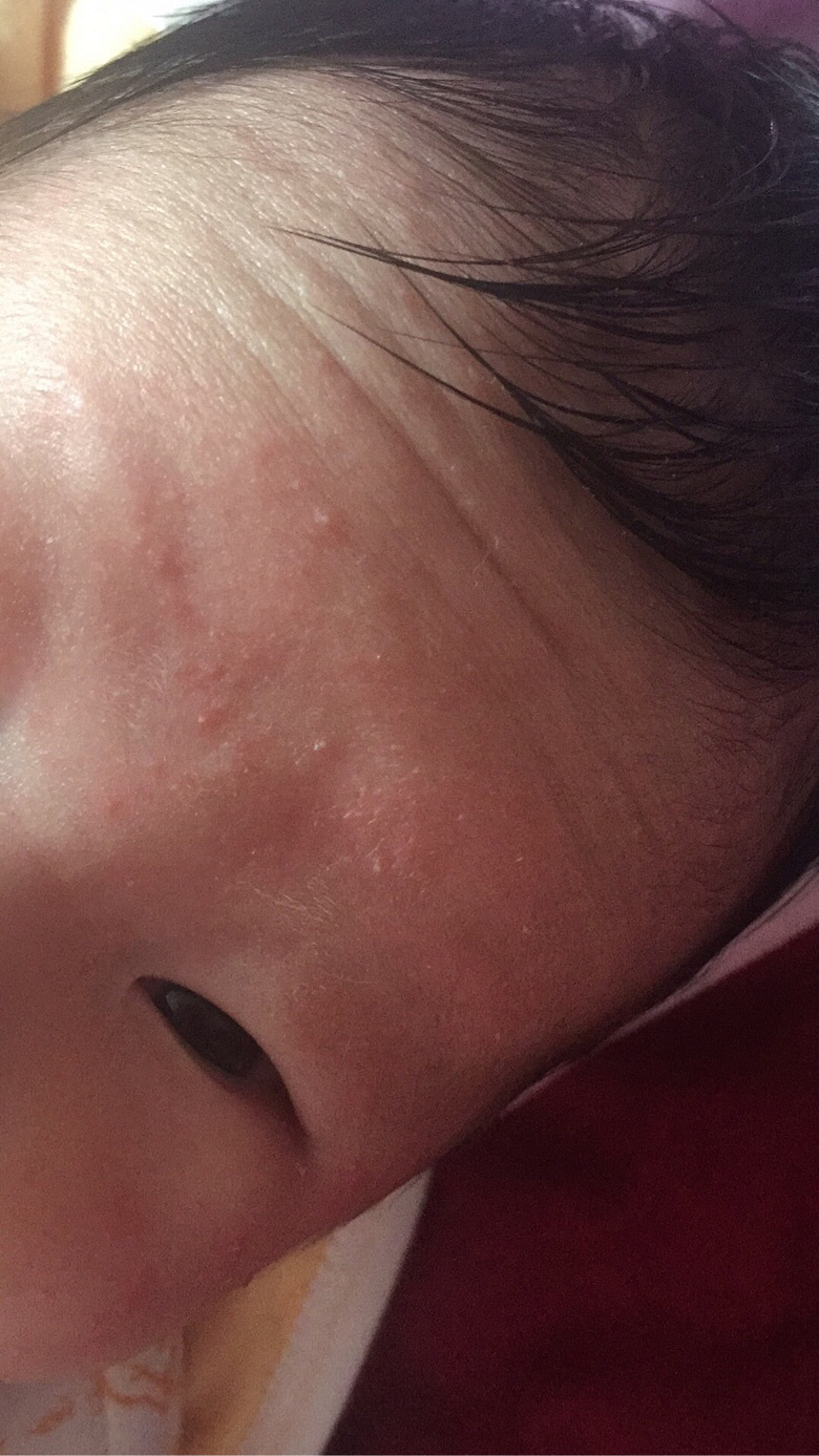 ����ʪ���� ��Ҫ��ô����