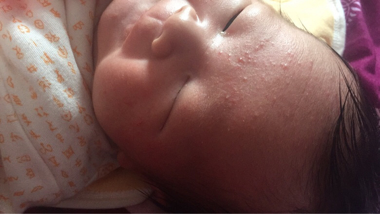 ����ʪ���� ��Ҫ��ô����