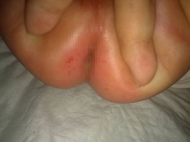 ������ƨ��