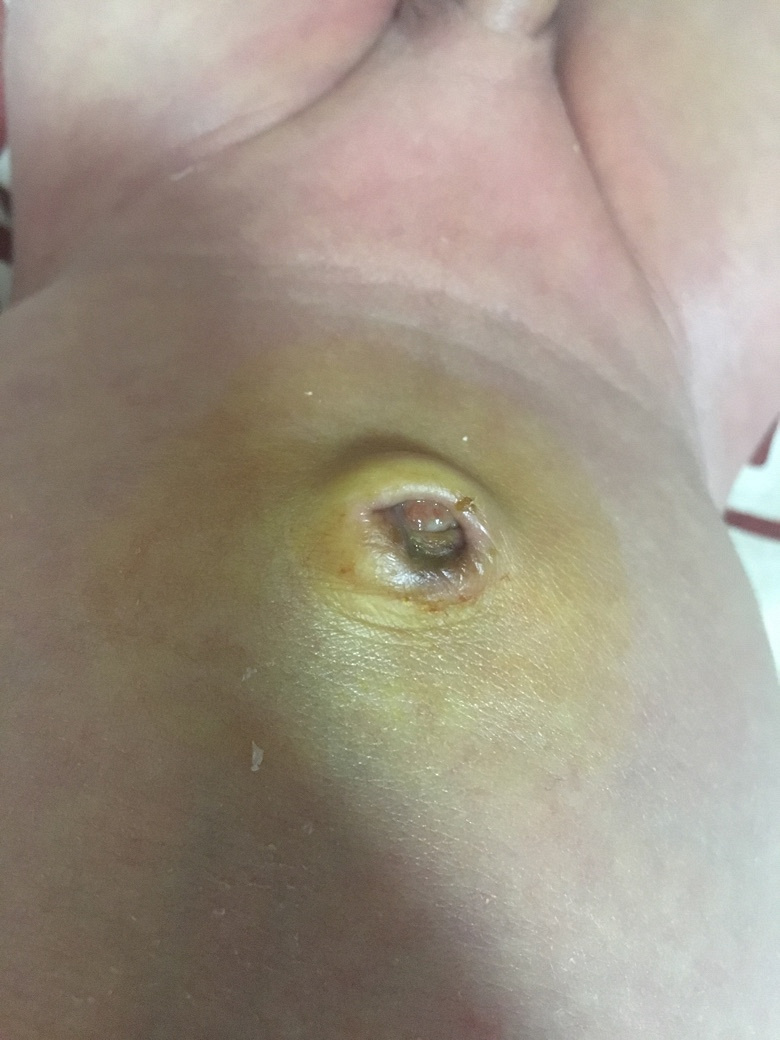 ����14��   ����᲻��