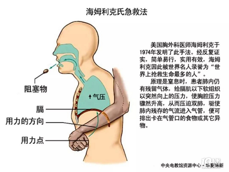 灯泡底座卡在肺里31年桐乡男子当年用灯泡学抽烟结果