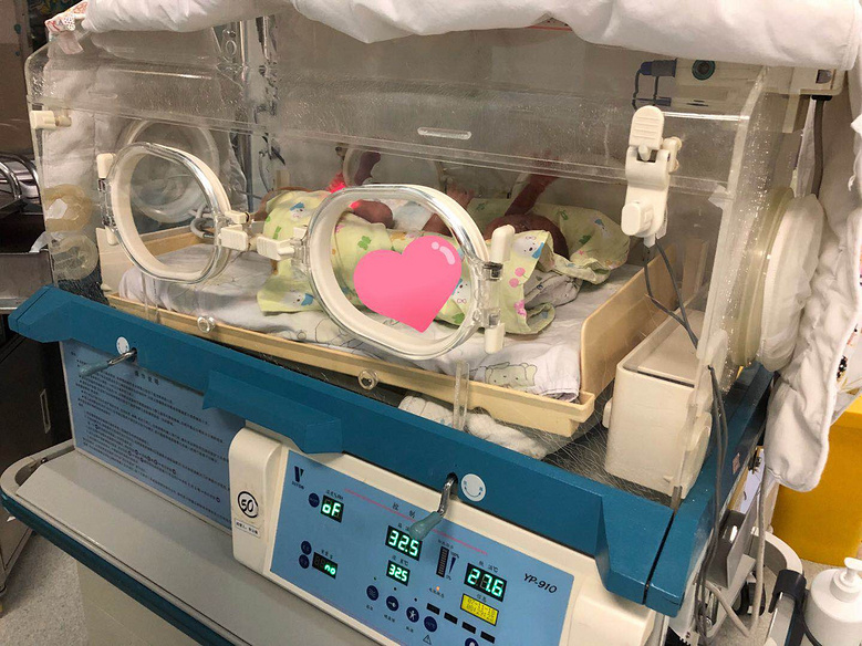 跟着周主任揭露市妇保新生儿重症监护室(NICU)那些你想知道的事