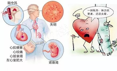 气温断崖式下降血压蹭蹭蹭上涨别急学会这几招从容应对