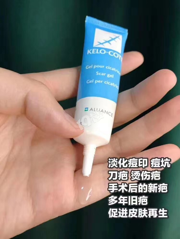 临安哪家药店有售巴克祛疤膏