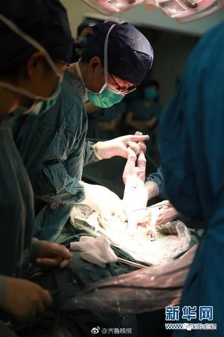 借母亲子宫女子成功生下自己的宝宝网友男人生娃岂不是