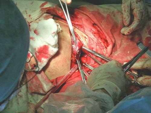 我的第n个母亲节见证生命的奇迹