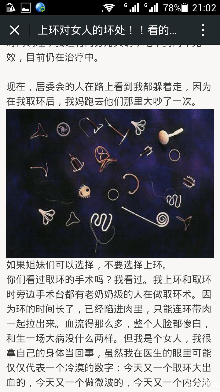 女人上环到底好不好