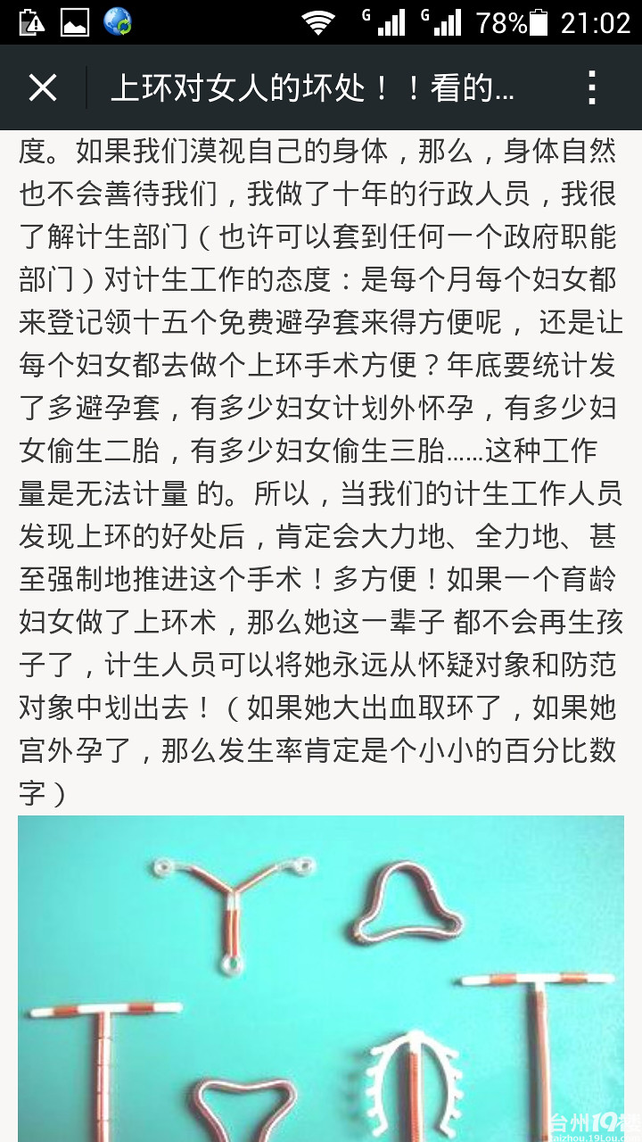 女人上环到底好不好