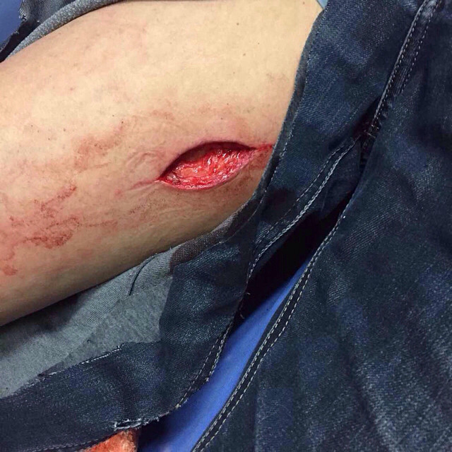 大白天在幼儿园门口拿刀砍人