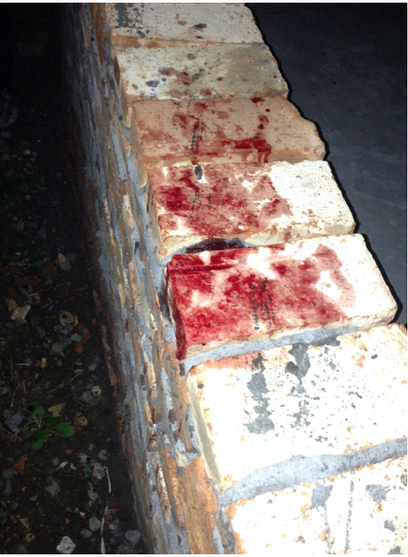 老人家被气出吐血了没钱没势的百姓命就不