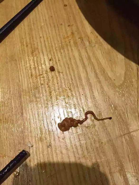 网爆牛蛙吃出寄生虫好恶心求证实