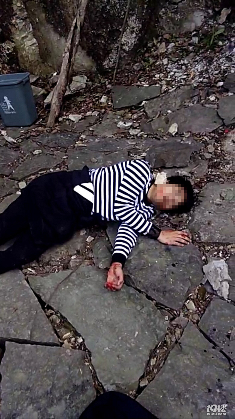 黄岩划岩山有人掉下来看起来摔得有点严重