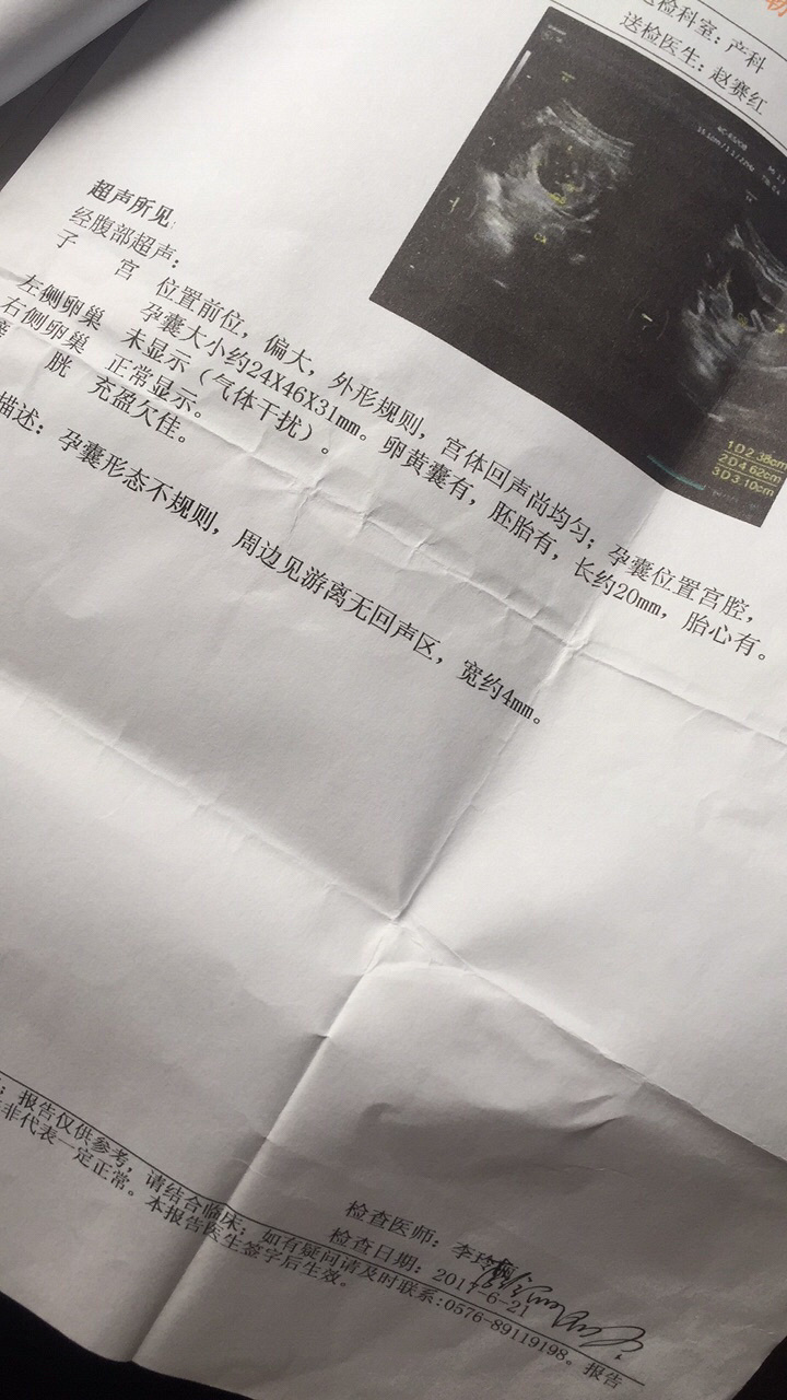 ����Ԫ���ڼ��Ԥ���ڵ����俴����