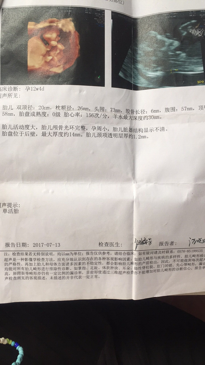 ����Ԫ���ڼ��Ԥ���ڵ����俴����