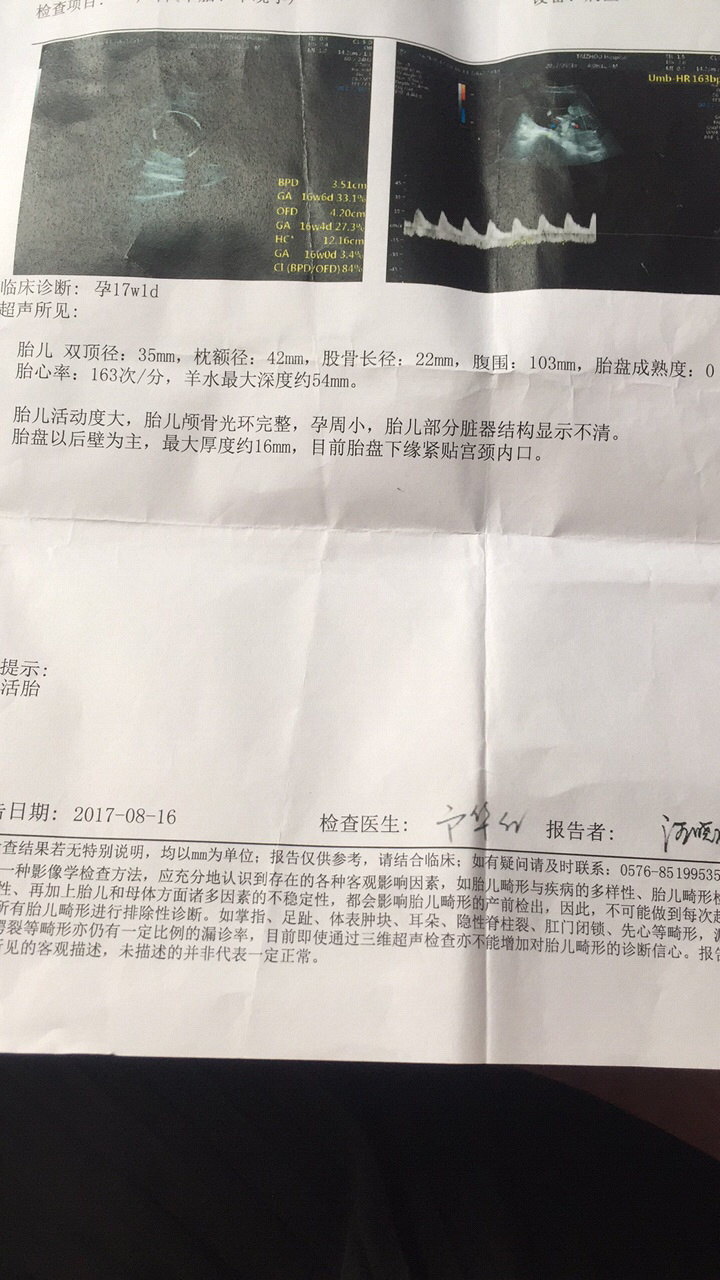 ����Ԫ���ڼ��Ԥ���ڵ����俴����