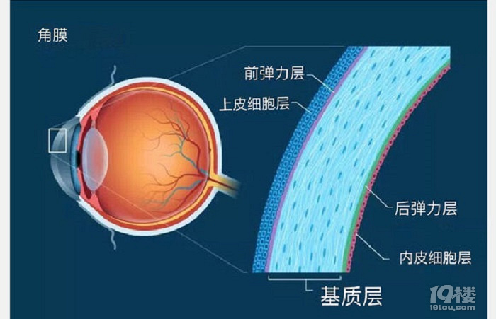 激光近视矫正的原理是什么你真的了解激光近视手术吗