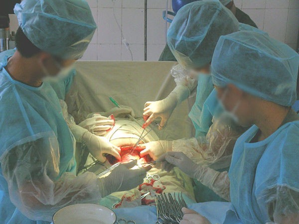 母爱的伟大之妈咪剖腹产的全过程组图